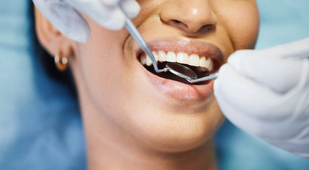 Best Emergency Denture Repair in Carolina Beach, NC